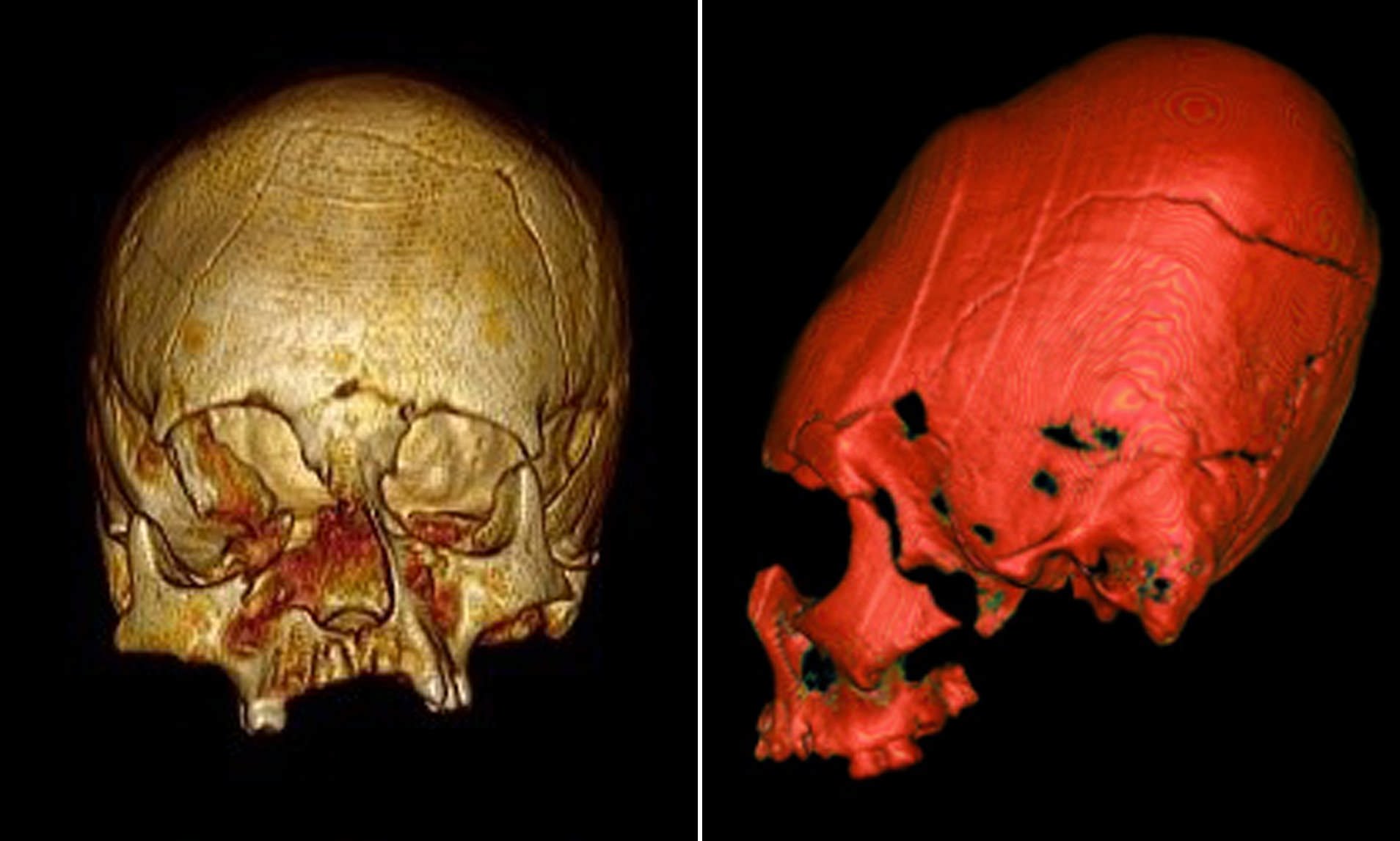 Arqueólogos descubren «cráneos extraterrestres» en Croacia (Video)