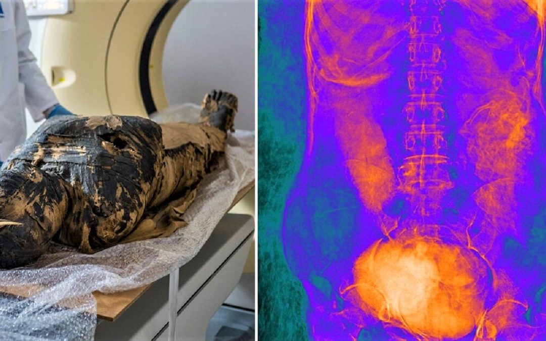 Encuentran por primera vez una momia egipcia embarazada (Video)